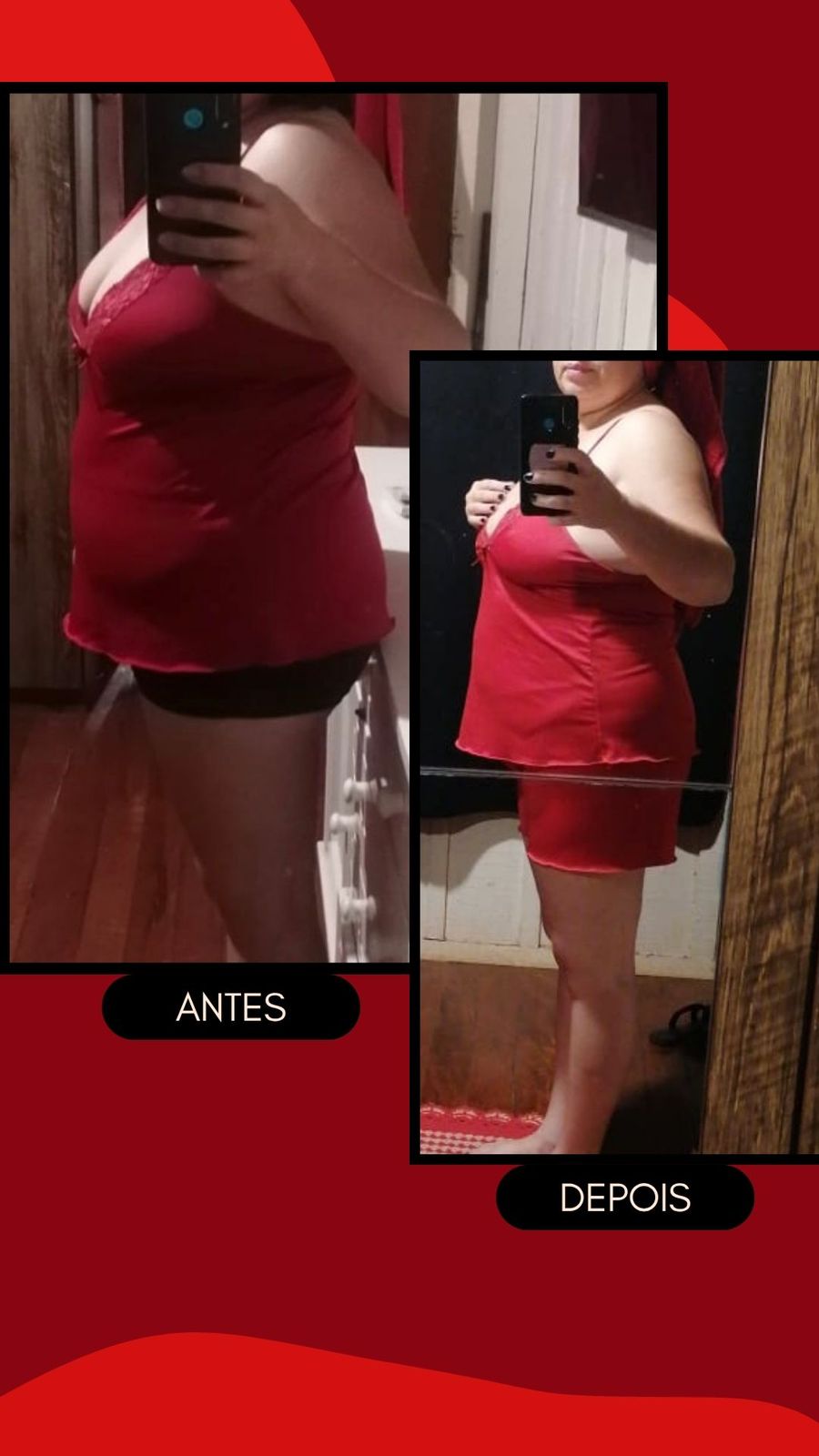 Resultado Antes e Depois — Alina Mendonça