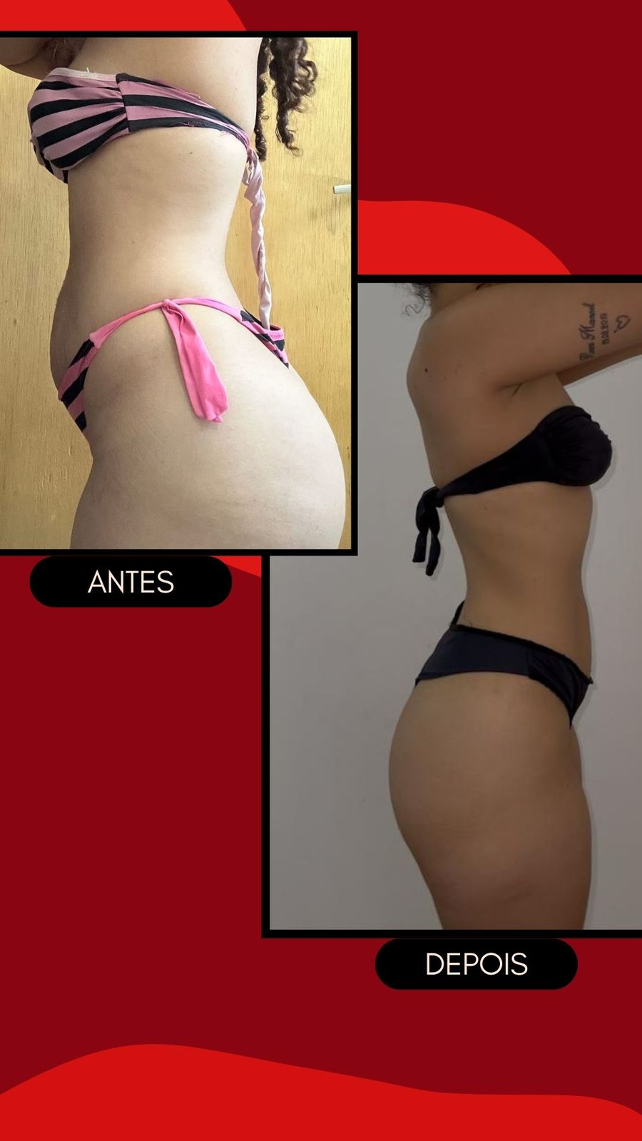 Resultado Antes e Depois — Mariana Souza