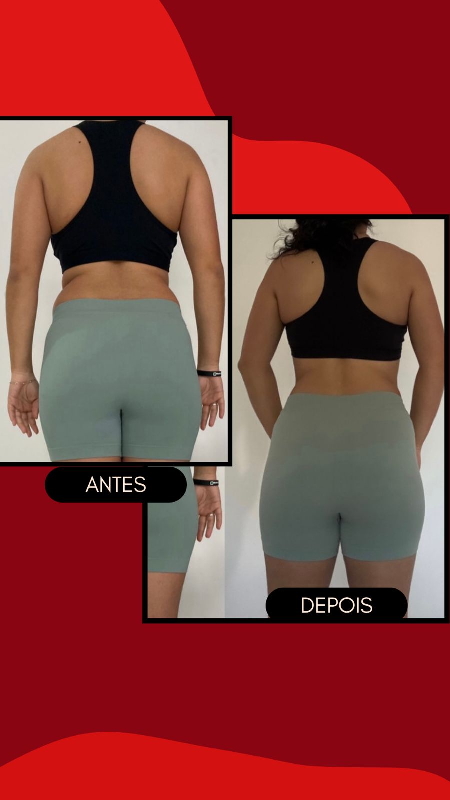 Resultado Antes e Depois — Gabriela Rodrigues